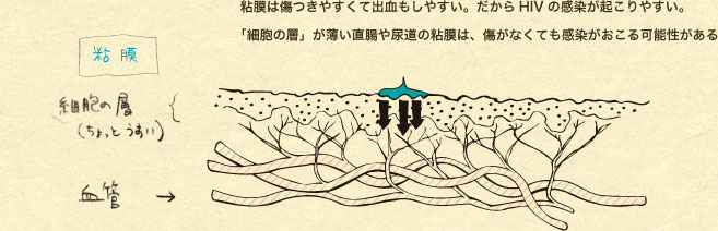 �S���͏����₷���ďo�������₷���B������HIV�̊������N����₷���B �u�זE�̑w�v������������A���̔S���́A�����Ȃ��Ă�������������\��������B